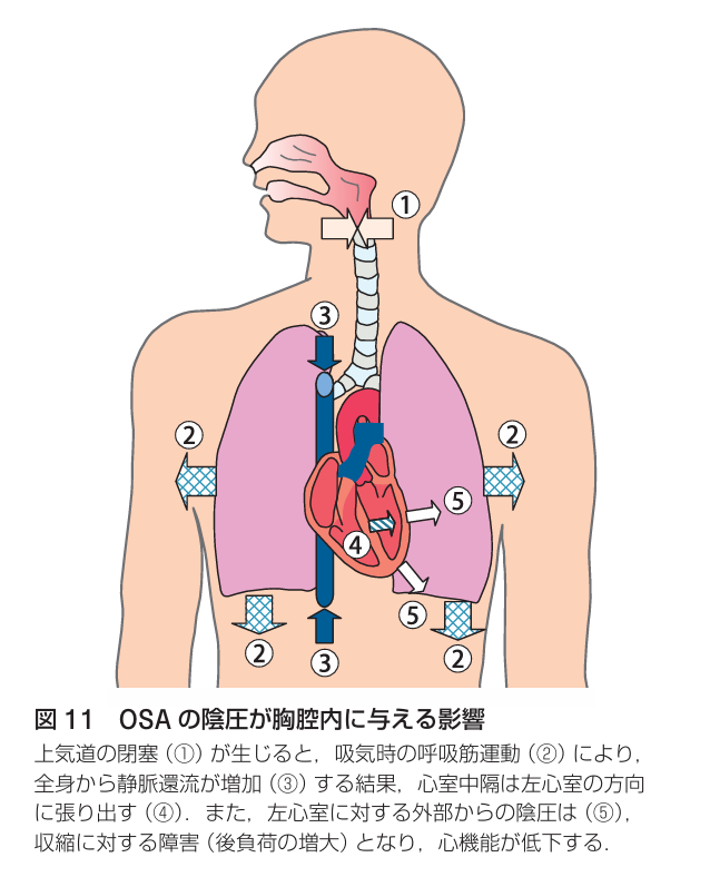 （１）胸腔内圧への影響のイメージ画像