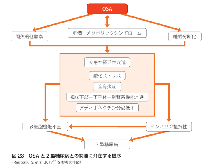 睡眠時無呼吸による糖尿病への悪影響のイメージ画像